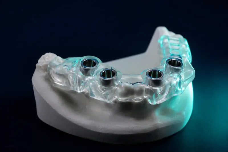 3D spausdintas chirurginis implantacijos gidas